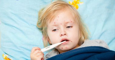 ضعف الجهاز المناعى مرتبط بالعدوى البكتيرية الخطيرة لدى الأطفال