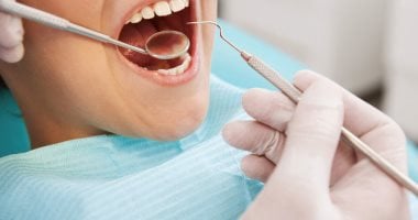 كيف تتعامل مع الأسنان بعد الحشو