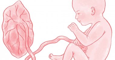 قصور وظائف المشيمة مشكلة تكتشف بأشعة الدوبلر وتهدد حياة الجنين
