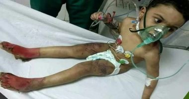 التضامن: اتخاذ الإجراءات القانونية ضد الأسرة فى واقعة تعذيب طفل كفر الشيخ