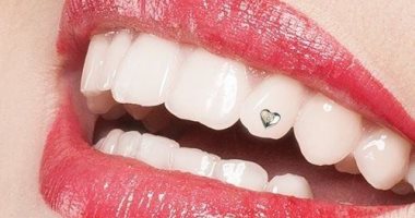 تجميل الأسنان انواعه عديدة أحدثهم الـ Veneers N3