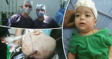 مدير طوارئ جامعة طنطا: الطفل زياد ضحية السيخ حرارته مستقرة وتحت الملاحظة