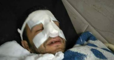 نقابة الأطباء: اعتداء على طبيب بمستشفى الساحل التعليمى وإصابته بكسور فى الأنف