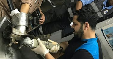 طوارئ المنصورة الجامعي تنقذ يد فتاة من البتر بعد انزلاق كفها في المفرمة