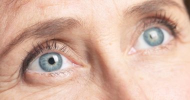 ما هى أعراض المياه البيضاء على العين؟ ومتى يلزم التدخل الجراحى لعلاجها؟