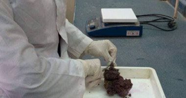 طالبة مصرية تقدم بحثا عن استخراج مواد من الشعب المرجانية لعلاج سرطان الثدى