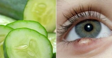 صحتك فى وصفة.. استخدم الألوفيرا والخيار لعلاج دمامل العين