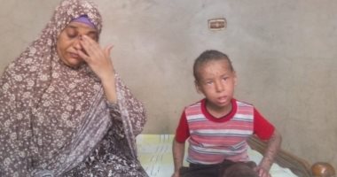 صور .. طفل مصاب بمرض جلدى نادر فى الشرقية .. وأمه: عاوزة ابنى يتعالج