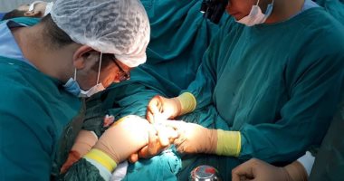 إجراء جراحة إصلاح ثانوى للعصب الزندى باليد اليمنى لطفل بمستشفى طور سيناء 