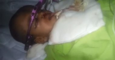 فيديو.. أب يناشد الصحة توفير طبيب أطفال لمتابعة حالة ابنه بطب أسنان الإسكندرية
