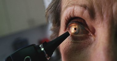 تطور جديد فى الطب.. كيف أصبحت العين وسيلة الكشف عن ألزهايمر
