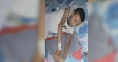 خطأ طبى بمستشفى أسيوط الجامعى يهدد ببتر ساق طفل