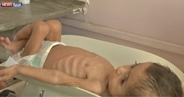 فيديو.. تحذير دولى من الوضع الإنسانى فى اليمن بعد فشل المفاوضات