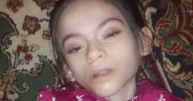 صور.. الطفلة "هبة" هيكل عظمى مصابة بمرض غير معروف وتصارع الموت بالشرقية 