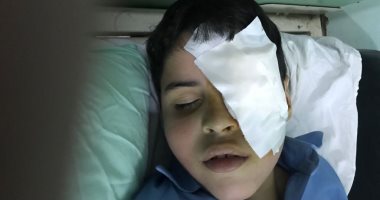تلميذ بالصف الثانى الابتدائى يفقأ عين زميله بمدرسة فى العاشر من رمضان