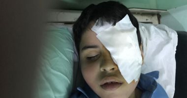  "أحمد" ذو 7 سنوات يفقد إحدى عينيه فى أول يوم دراسى بالشرقية
