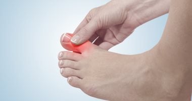 What is gout? .. What are its symptoms and treatment?