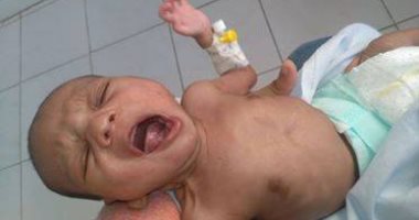 قارىء يستغيث بوزيرة الصحة و يطالب بلبن حساسية القمح لطفله الرضيع  