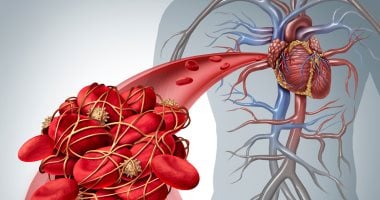 مضاعفات كورونا قد تصيب الأشخاص الذين يعانون من مخاطر وراثية لتجلط الدم