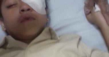 إصابة تلميذة فى العين أثناء لهوها داخل مدرسة نجع حسان الإبتدائية بالأقصر