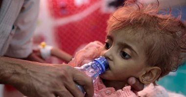 فيس بوك يزيل آلاف المشاركات لمقالة تناولت معاناة أطفال اليمن