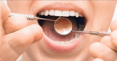 التهاب اللثة مرض خطير إهماله يفقدك أسنانك