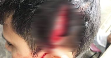صور.. طالب يعتدى على زميله بموس فى مدرسة بالمرج ويصيبه بجروح قطعية