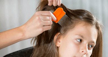 الوقاية خير من العلاج.. ازاى تحمى أطفالك من حشرات الشعر