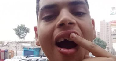 صور.. قارئ يشكو مدرس ثانوى تعدى على نجله بالضرب وكسر أسنانه فى المحلة