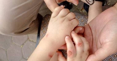 فيديو وصور.. محمود يتهم مطلقته بتعذيب طفليه ويطالب بحضانتهما بعد زواجها