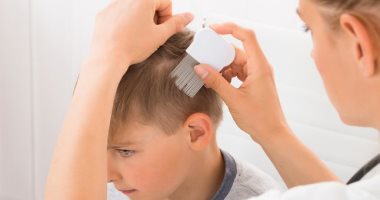 اسباب تساقط الشعر عند الأطفال وطرق العلاج