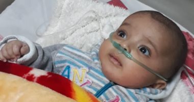 مواطن يحرر محضرا ضد مستشفى بالوراق بعد حرق طفله بسبب الإهمال الطبى