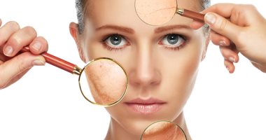 3 وصفات طبيعية لإزالة آثار الحروق من الجلد