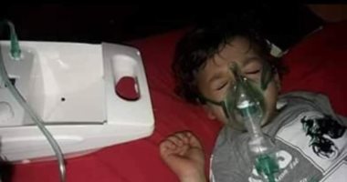 استجابة لـ"اليوم السابع".. "الصحة" تتكفل بعلاج الطفل محمود بعد نشر معاناته