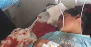 صور.. "منال" طفلة مصابة بنزيف حاد وتستغيث بوزيرة الصحة لإنقاذ حياتها