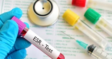 لو عملت تحليل ESR..ماذا يعنى ارتفاع أو انخفاض سرعة الترسيب فى الدم؟
