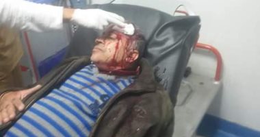 صور.. سكرتير عام بورسعيد: إصابة موظف بحى المناخ أثناء حملة إزالة مخالفات