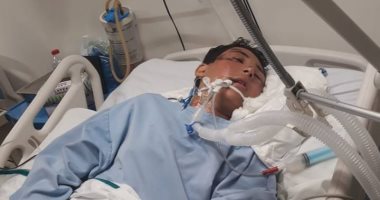 والدة "مصطفى" تناشد المساعدة فى علاجه بعد إصابات مضاعفة فى حادث
