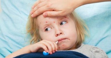 مع انتشار الحصبة عالمياً.. كيف يساعد التطعيم على وقاية طفلك؟