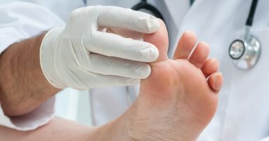 كيف تكتشف إصبع القدم المكسور وكم تستغرق مدة علاجه؟