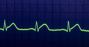 باحثون يطورون مكبرات صوت قادرة على مراقبة نبضات القلب