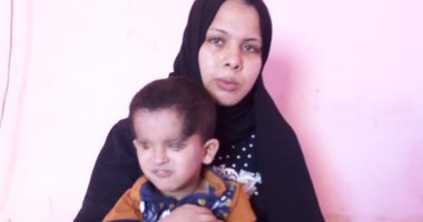 صور.. مأساة الطفل كريم ولد بدون عينه اليمنى وأسرته تناشد علاجه