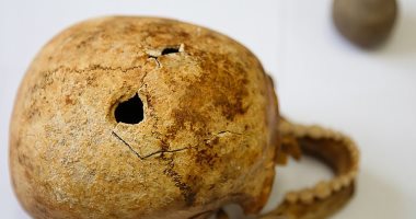 اكتشاف جمجمة محارب أجريت له عملية جراحية منذ 4 آلاف سنة.. اعرف التفاصيل