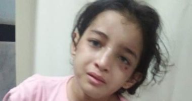 النيابة تطلب تقرير الطب الشرعى لطفلة تعرضت للتعذيب على يد زوجة والدها بدمياط
