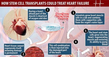 علاج ثورى لقصور القلب بتجديد الأنسجة الميتة باستخدام الخلايا الجذعية