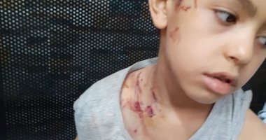 فيديو وصور ..هجوم للكلاب الشرسة على الأطفال بمدينة العبور