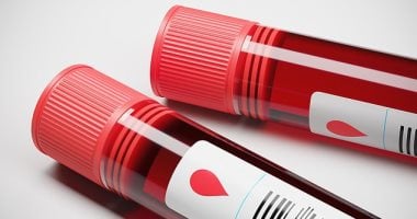 تحليل نسبة اليوريا في الدم يكشف عن كفاءة عمل الكليتين