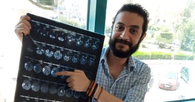 "مستشفى أرمنت":استقرار حالة طبيب حاول الإنتحار بعد إصابته بجلطة بالمخ