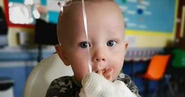 صور.. طفل 9 أشهر يقاتل نوعا نادرا من سرطان الخصية بعد اعتقاد الأطباء أنه فتق