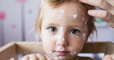 ما هو مرض اليد والقدم والفم الذى يصيب الأطفال؟